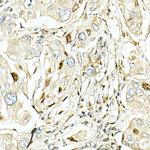 LKB1 Antibody in Immunohistochemistry (Paraffin) (IHC (P))