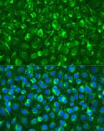 Syk Antibody in Immunocytochemistry (ICC/IF)