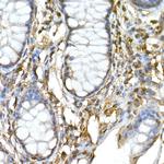 TNFAIP3 Antibody in Immunohistochemistry (Paraffin) (IHC (P))