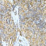 TNFAIP3 Antibody in Immunohistochemistry (Paraffin) (IHC (P))