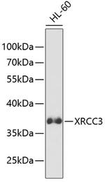 XRCC3 Antibody in Western Blot (WB)