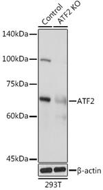 ATF Antibody in Western Blot (WB)