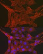 Caspase 3 Antibody in Immunocytochemistry (ICC/IF)