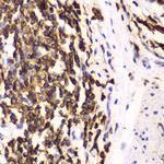 HCLS1 Antibody in Immunohistochemistry (Paraffin) (IHC (P))