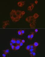 Complement Factor H Antibody in Immunocytochemistry (ICC/IF)