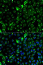 Cytokeratin 17 Antibody in Immunocytochemistry (ICC/IF)