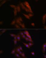 Presenilin 1 Antibody in Immunocytochemistry (ICC/IF)