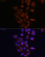 Presenilin 1 Antibody in Immunocytochemistry (ICC/IF)