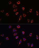 Presenilin 1 Antibody in Immunocytochemistry (ICC/IF)