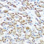 Presenilin 1 Antibody in Immunohistochemistry (Paraffin) (IHC (P))