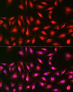 p70 S6 Kinase Antibody in Immunocytochemistry (ICC/IF)