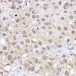 p70 S6 Kinase Antibody in Immunohistochemistry (Paraffin) (IHC (P))