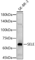 CD62E (E-selectin) Antibody in Western Blot (WB)