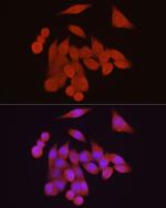 VDR Antibody in Immunocytochemistry (ICC/IF)