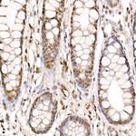 PRMT4 Antibody in Immunohistochemistry (Paraffin) (IHC (P))