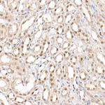 PRMT4 Antibody in Immunohistochemistry (Paraffin) (IHC (P))