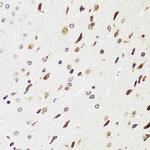 EDF1 Antibody in Immunohistochemistry (Paraffin) (IHC (P))