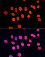 H3K9me1 Antibody in Immunocytochemistry (ICC/IF)