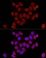 H3K27me2 Antibody in Immunocytochemistry (ICC/IF)