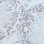 H3K36me2 Antibody in Immunohistochemistry (Paraffin) (IHC (P))