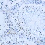 H3K36me2 Antibody in Immunohistochemistry (Paraffin) (IHC (P))