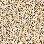 H3K36me3 Antibody in Immunohistochemistry (Paraffin) (IHC (P))