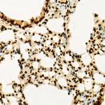 H3K36me3 Antibody in Immunohistochemistry (Paraffin) (IHC (P))