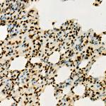 H3K36me3 Antibody in Immunohistochemistry (Paraffin) (IHC (P))