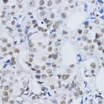 H3K79me2 Antibody in Immunohistochemistry (Paraffin) (IHC (P))