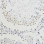 H4K20me3 Antibody in Immunohistochemistry (Paraffin) (IHC (P))