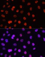 H3R17me2a Antibody in Immunocytochemistry (ICC/IF)