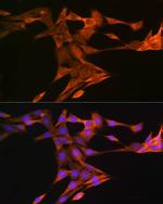 SQLE Antibody in Immunocytochemistry (ICC/IF)