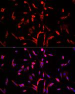 SQLE Antibody in Immunocytochemistry (ICC/IF)