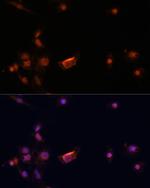 BRCA2 Antibody in Immunocytochemistry (ICC/IF)