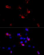 Filamin B Antibody in Immunocytochemistry (ICC/IF)