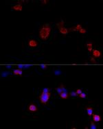 Filamin B Antibody in Immunocytochemistry (ICC/IF)