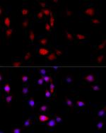 Filamin B Antibody in Immunocytochemistry (ICC/IF)