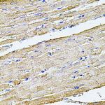 Filamin B Antibody in Immunohistochemistry (Paraffin) (IHC (P))