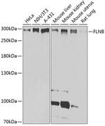 Filamin B Antibody in Western Blot (WB)