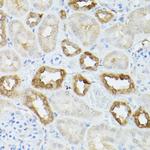 HSC70 Antibody in Immunohistochemistry (Paraffin) (IHC (P))