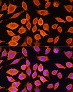 SIAH1 Antibody in Immunocytochemistry (ICC/IF)