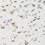 SIAH1 Antibody in Immunohistochemistry (Paraffin) (IHC (P))