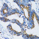 SIAH1 Antibody in Immunohistochemistry (Paraffin) (IHC (P))