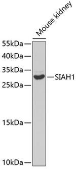 SIAH1 Antibody in Western Blot (WB)