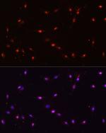 ILF3 Antibody in Immunocytochemistry (ICC/IF)