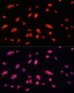 ILF3 Antibody in Immunocytochemistry (ICC/IF)