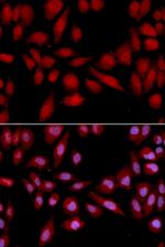 PSMA2 Antibody in Immunocytochemistry (ICC/IF)