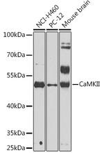 CaMKII beta Antibody in Western Blot (WB)