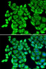 EEF1D Antibody in Immunocytochemistry (ICC/IF)