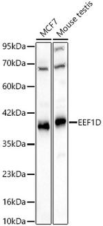 EEF1D Antibody in Western Blot (WB)